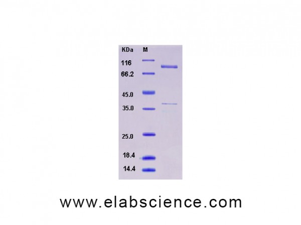 Recombinant Human AMPK (G1/B2/A1) Heterotrimer Protein