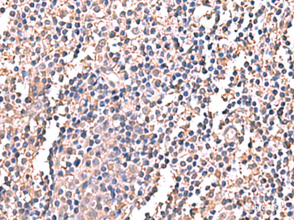 Anti-LDHAL6B