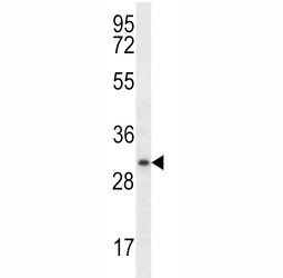 Anti-Myogenin