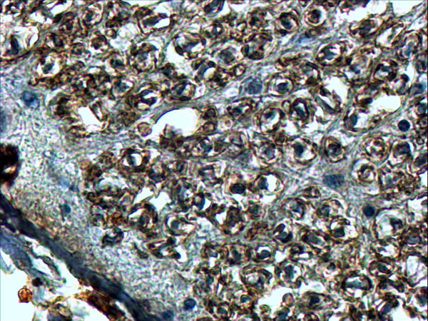 Anti-SLIT2, Internal