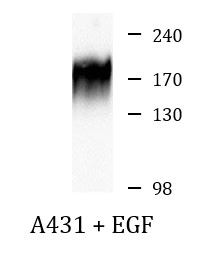 Anti-phospho-EGFR (Tyr992)