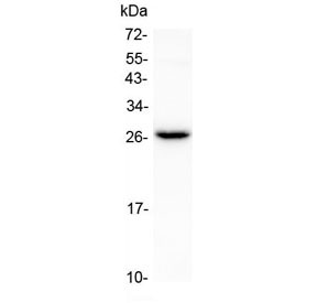 Anti-Flt3 ligand