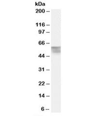 Anti-Thyroid hormone receptor alpha