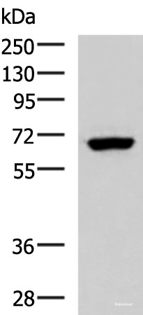 Anti-PPP2R1A