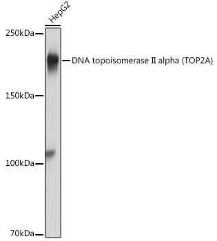 Anti-DNA topoisomerase II alpha (TOP2A)