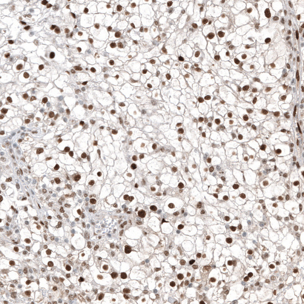 Anti-ABCB5, clone CL12822