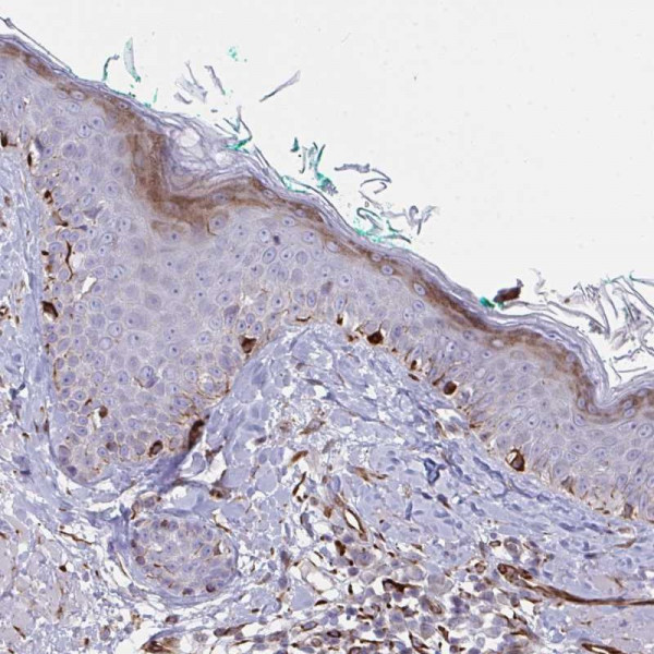 Anti-DCBLD1