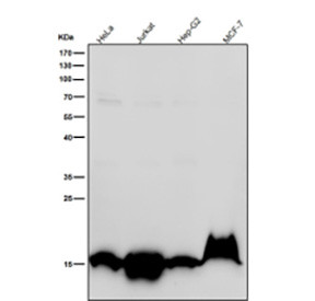 Anti-Histone H3 (acetyl K36) / HIST1H3A, clone 31H90