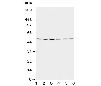 Anti-Presenilin 2