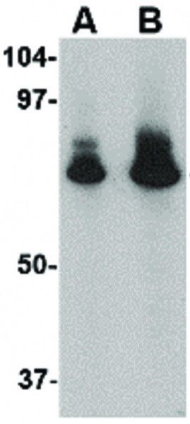 Anti-ATG16