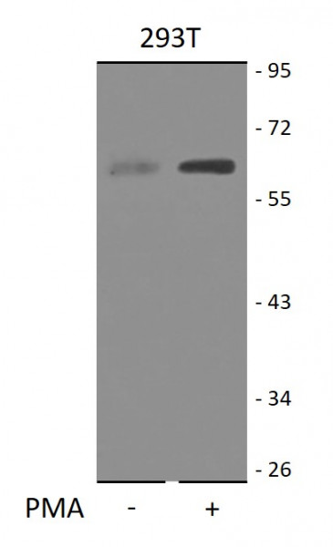 Anti-phospho-Smad2 (Ser467)