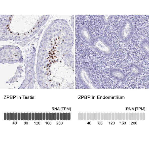 Anti-ZPBP