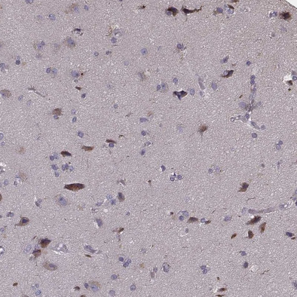 Anti-PCDHA4
