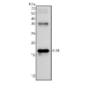 Anti-Interleukin 1 beta / IL1B, clone 28I10