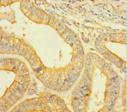Anti-CASP1