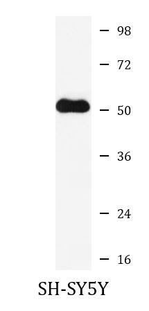 Anti-SLIT2