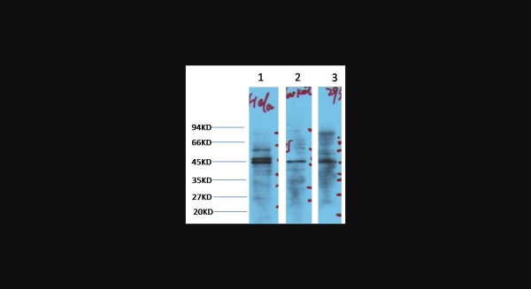 Anti-NSE, monoclonal