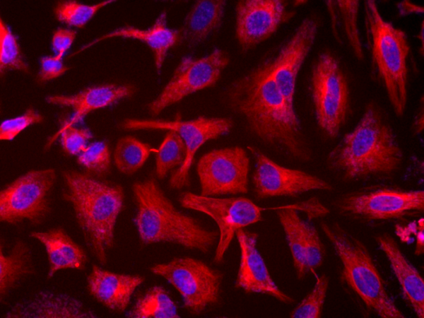 Tubulite(TM) Red *Cell-Permeable*