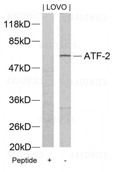 Anti-ATF2 (Ab-73 or 55)