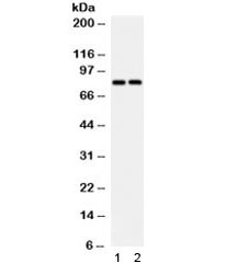 Anti-SLC15A2