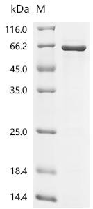 Sestrin-2 (SESN2), recombinant human