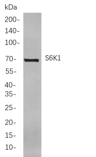 Anti-Recombinant S6K1, clone 11B5