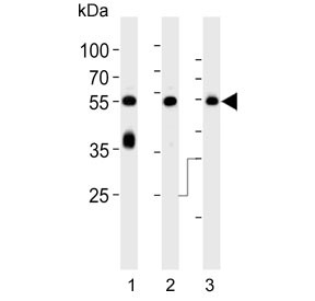 Anti-PACSIN1