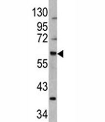 Anti-MDM2