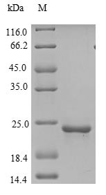 Cell surface hyaluronidase (TMEM2), partial, human, recombinant