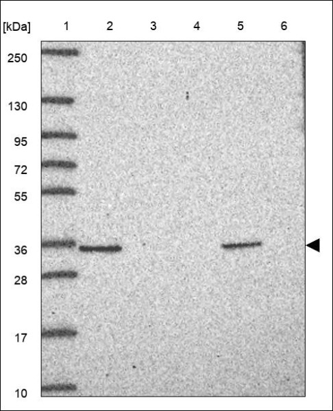 Anti-FRG1