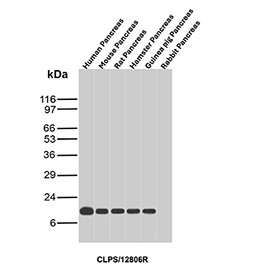 Anti-CLPS / Colipase, clone CLPS/12806R
