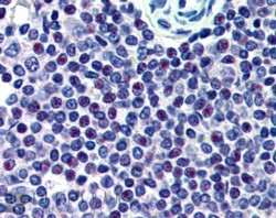 Anti-HMG20A