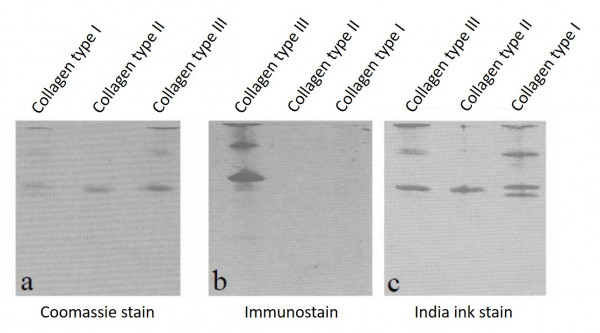 Anti-Collagen III (Cyanogen Bromide Fragments)