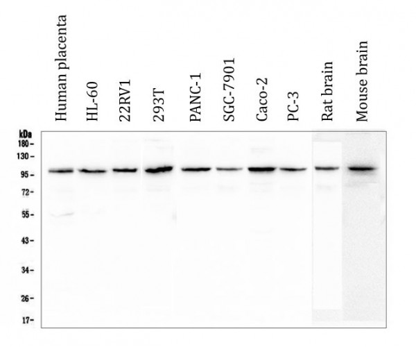 Anti-Plasminogen