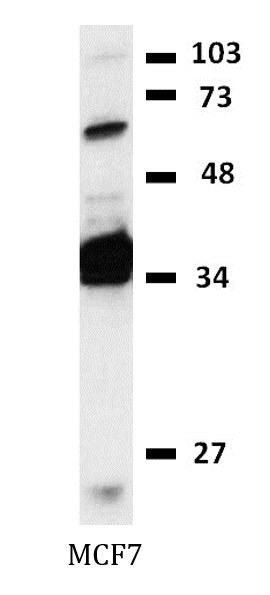 Anti-Cytokeratin 19, clone BA-17 (Biotin)