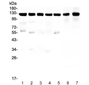 Anti-Amyloid beta / APP