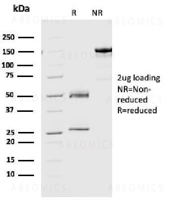 Anti-Geminin / DNA Replication Inhibitor Monoclonal Antibody (Clone: CPTC-GMMN-1)
