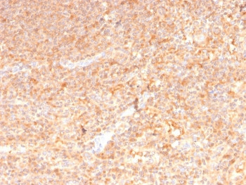 Anti-Granulocyte-Macrophage CSF / CSF2, clone CSF2/3402