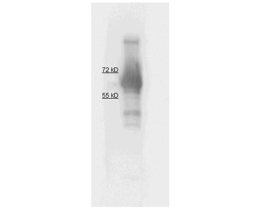 Anti-ALKALINE PHOSPHATASE (Calf Intestine)