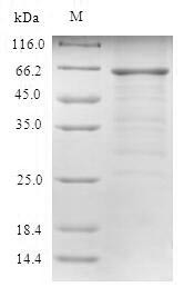 UV excision repair protein RAD23 homolog A (RAD23A), human, recombinant