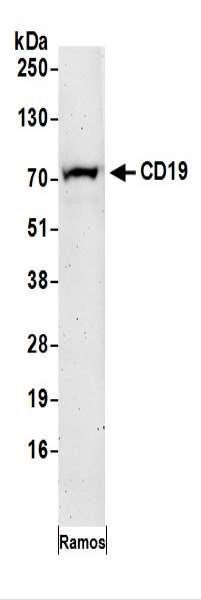 Anti-CD19