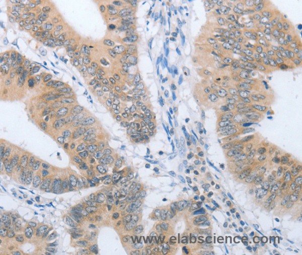 Anti-CHRNA10
