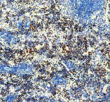 Anti-Ki-67 / MKI67, clone 31K02