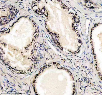 Anti-UBE2F / NEDD8-conjugating enzyme E2 F