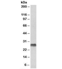 Anti-HLA-DQA2