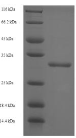 CMP-N-acetylneuraminate-poly-alpha-2,8-sialyltransferase (ST8SIA4), human, recombinant