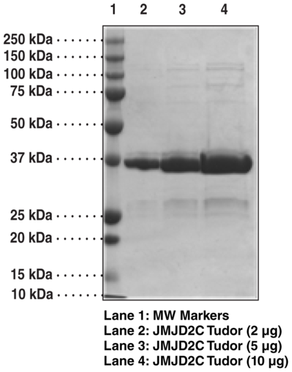 JMJD2C tudor domain (human, recombinant)