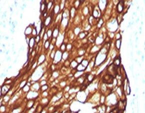 Anti-Acidic Cytokeratin, clone RMAK1-1
