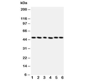 Anti-HDAC3