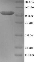 Tubulin beta-2A chain (TUBB2A), human, recombinant